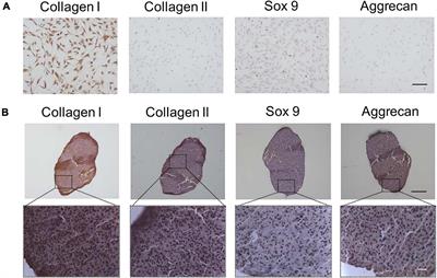 Type II Collagen Sponges Facilitate Tendon Stem/Progenitor Cells to Adopt More Chondrogenic Phenotypes and Promote the Regeneration of Fibrocartilage-Like Tissues in a Rabbit Partial Patellectomy Model